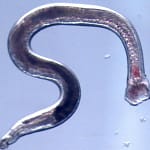 Engineered hookworms could one day dispense drugs from inside your gut