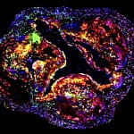 Sleep and exercise may dampen genetic drivers of heart disease
