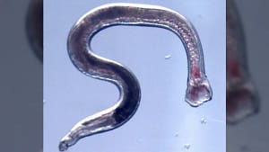 Engineered hookworms could one day dispense drugs from inside your gut