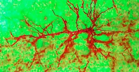 Growing new neurons in the human adult brain