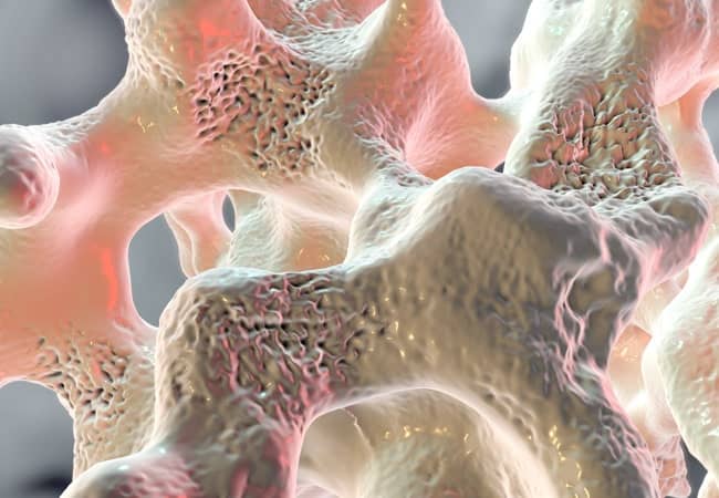 Postmenopausal bone loss